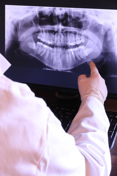 Best Emergency Root Canal Treatment in Rockdale, TX