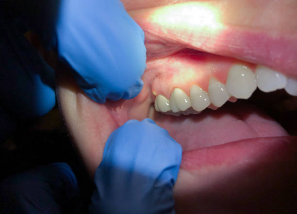 Best Mobile Emergency Dentist in Rockdale, TX