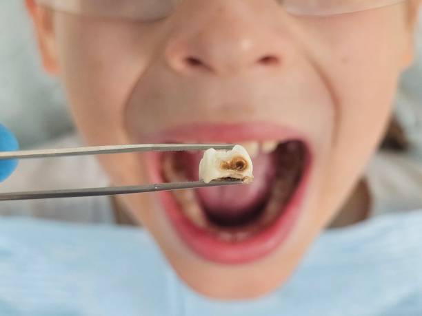 Best 24-Hour Emergency Dentist in Rockdale, TX